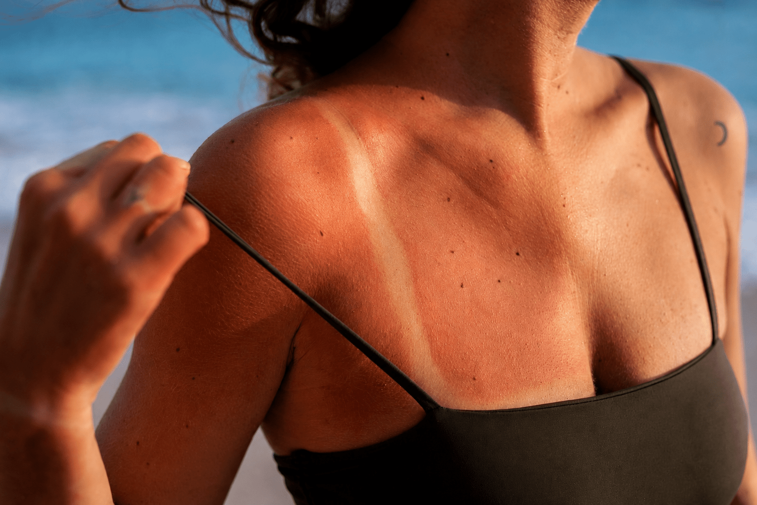 Nei e sole: preparare la pelle all&rsquo;estate parte dalla prevenzione